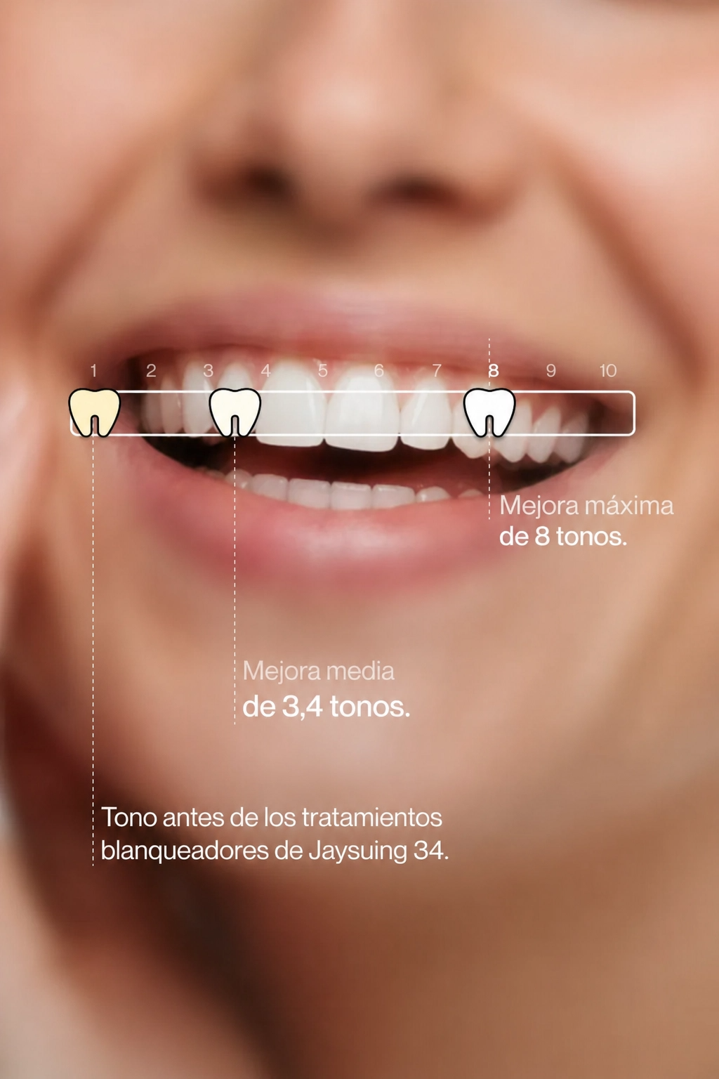 Jaysuing v34 blanqueador dental